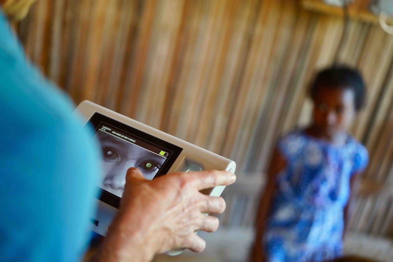 Dépistage visuel d'une enfant avec un autoréfractomètre portable, lors d'une mission humanitaire